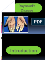 Raynaud's Disease - JERAIZA