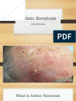 Actinic Keratosis