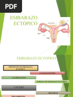 Embarazo Ectopico y Aborto