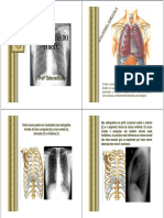 Patologias Do Tórax