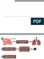 NEUMONIA Diapositivas