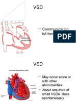 VSD