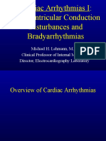 Cardiac Arrhythmias I: Atrioventricular Conduction Disturbances and Bradyarrhythmias