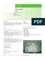 Sondaje Vesical PDF