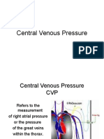 Central Venous Pressure