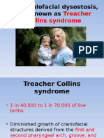 T Collins Syndrome