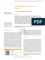 A Case Report of Desmoplastic Ameloblastoma