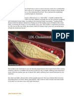 Understand LDL Cholesterol Better