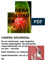 Cadera Dolorosa