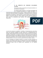 Resistencia Al Impacto de Fuerzas Oclusivas