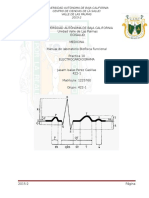 Electrocardiogram A