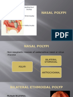 Nasal Polyp