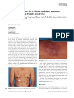 Lepromatous Leprosy in Erythema Nodosum Leprosum Reaction Mimicking Sweet's Syndrome