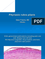  Pityriasis Rubra Pilaris. M 64, Left Foot