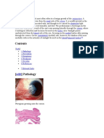 Pterygium