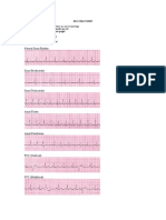 Ekg Cheat Sheet