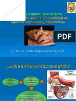 Lupus y Espondilitis