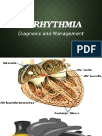 Arrhythmia: Diagnosis and Management