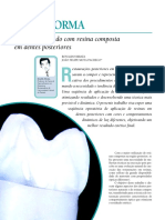 Cor e Forma en Dentes Posteriores Hirata