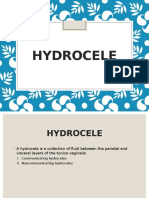 Hydrocele