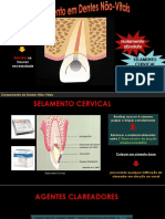 Clareamento Dental