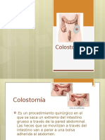 Colostomía