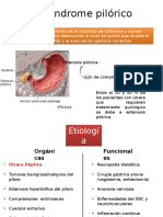 Sindrome Pilorico