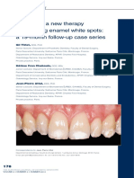 Infiltration, A New Therapy For Masking Enamel White Spot PDF