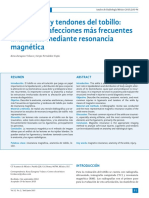 2013 Ligamentos y Tendones Del Tobillo. Anatomía y Afecciones Más Frecuentes Analizadas Mediante RM