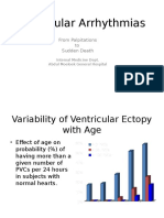 Ventricular Arrhythmias: From Palpitations To Sudden Death