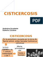 Cisticercosis