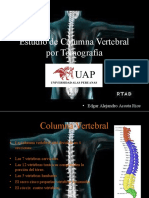 Estudio de Columna Vertebral Por Tomografía