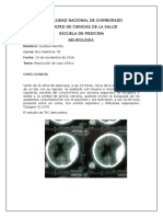 Caso Clinico Tce