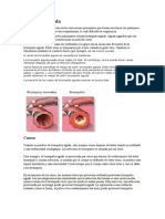 Bronquitis Aguda