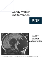 Dandy Walker Malformation