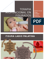 Terapia Miofuncional en Fisurados