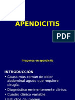 Apendicitis 111117185102 Phpapp02