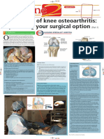 3 LWG Knee Pain Part 1