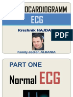 Electrocardiogramm - Ecg Interpretation