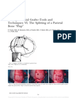 Taking Calvarial Grafts - Tools and Techniques - VI. The Splitting of A Parietal Bone "Flap"