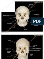 Pcgcadaveraxialskulla p1