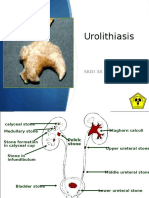 Urolithiasis