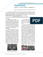 IMF Screws As An Alternative To Arch Bar Fixation in Management of Mandibular Fracture