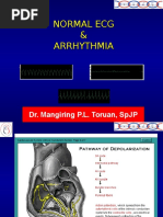 Normal Ecg & Arrhythmia