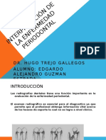 Interpretación de La Enfermedad Periodontal