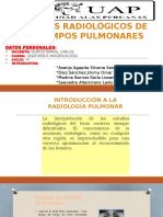 Campos Pulmonares