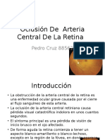 Oclusión de Arteria Central de La Retina