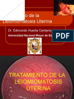 Leiomiomatosis Uterina 2