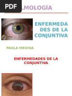 Enfermedades Dela Conjuntiva