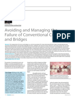 Avoiding and Managing The Failure of Conventional Crowns and Bridges